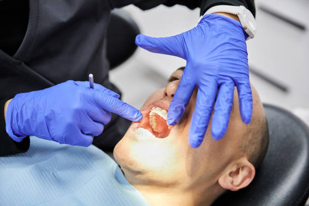 Best Emergency Wisdom Teeth Removal in Hartford, AL
