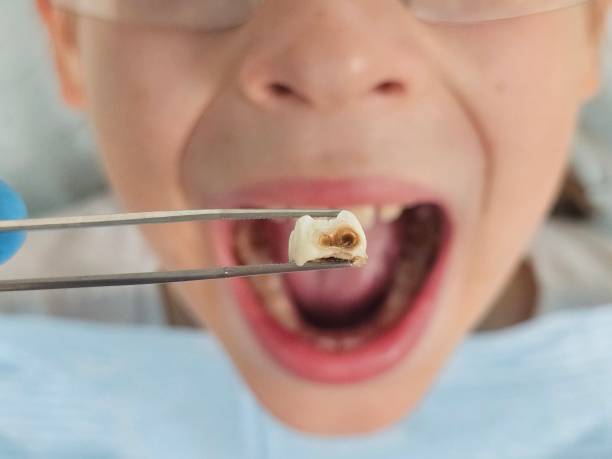 Best Pediatric Emergency Dentist in Hartford, AL